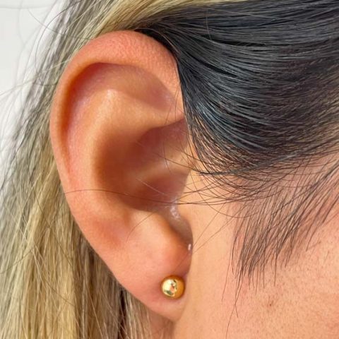 Arete bomba